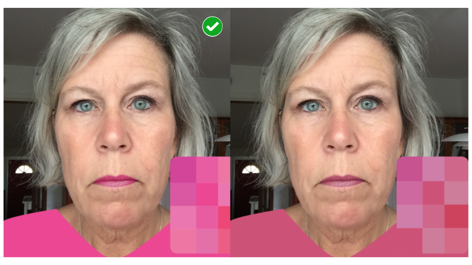 Case Study: Grey Hair With Bright Teal Eyes